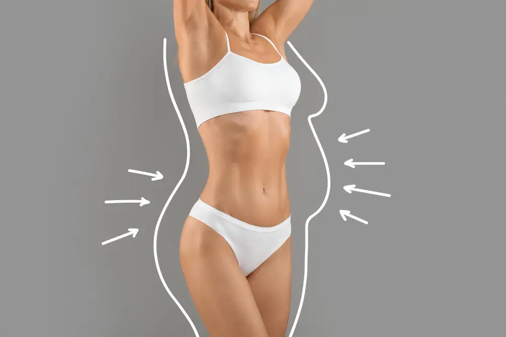 Liposuction