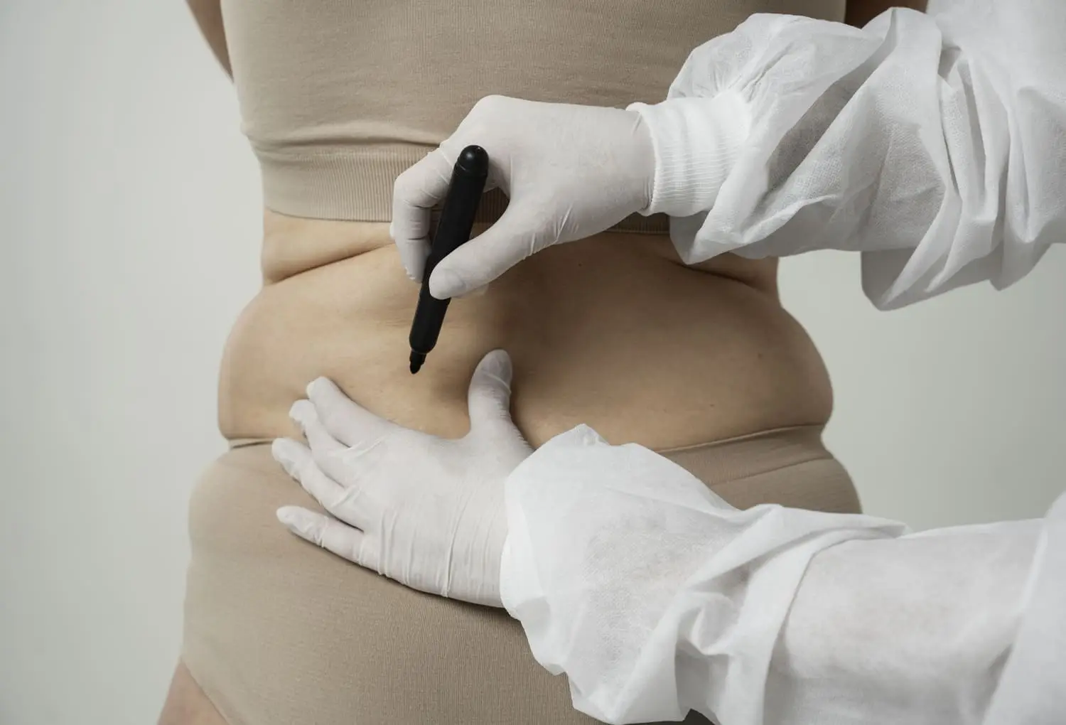 360 Liposuction
