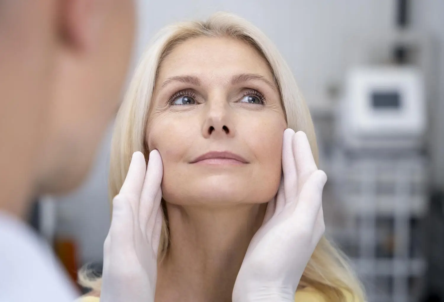 Mid-Face Lift