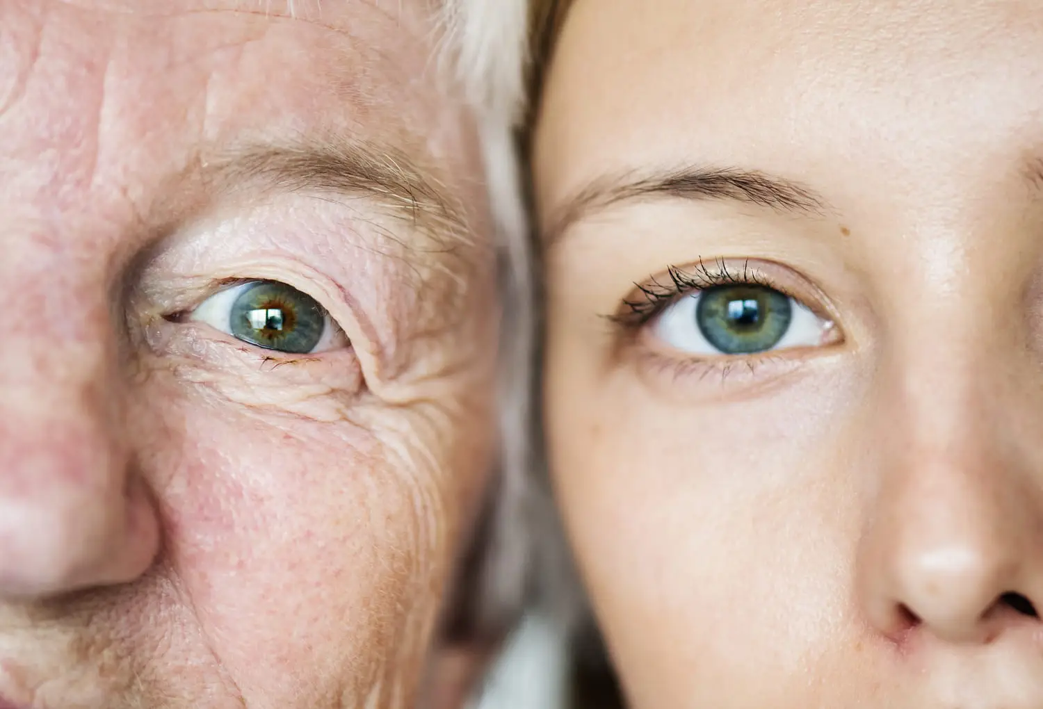 หน้าแก่ก่อนวัย, Premature Aging