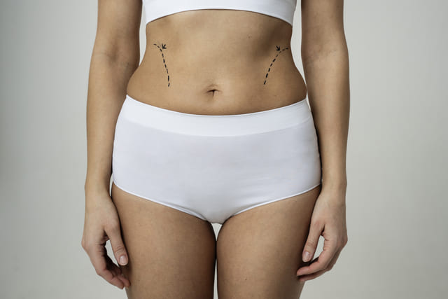 360 liposuction thailand