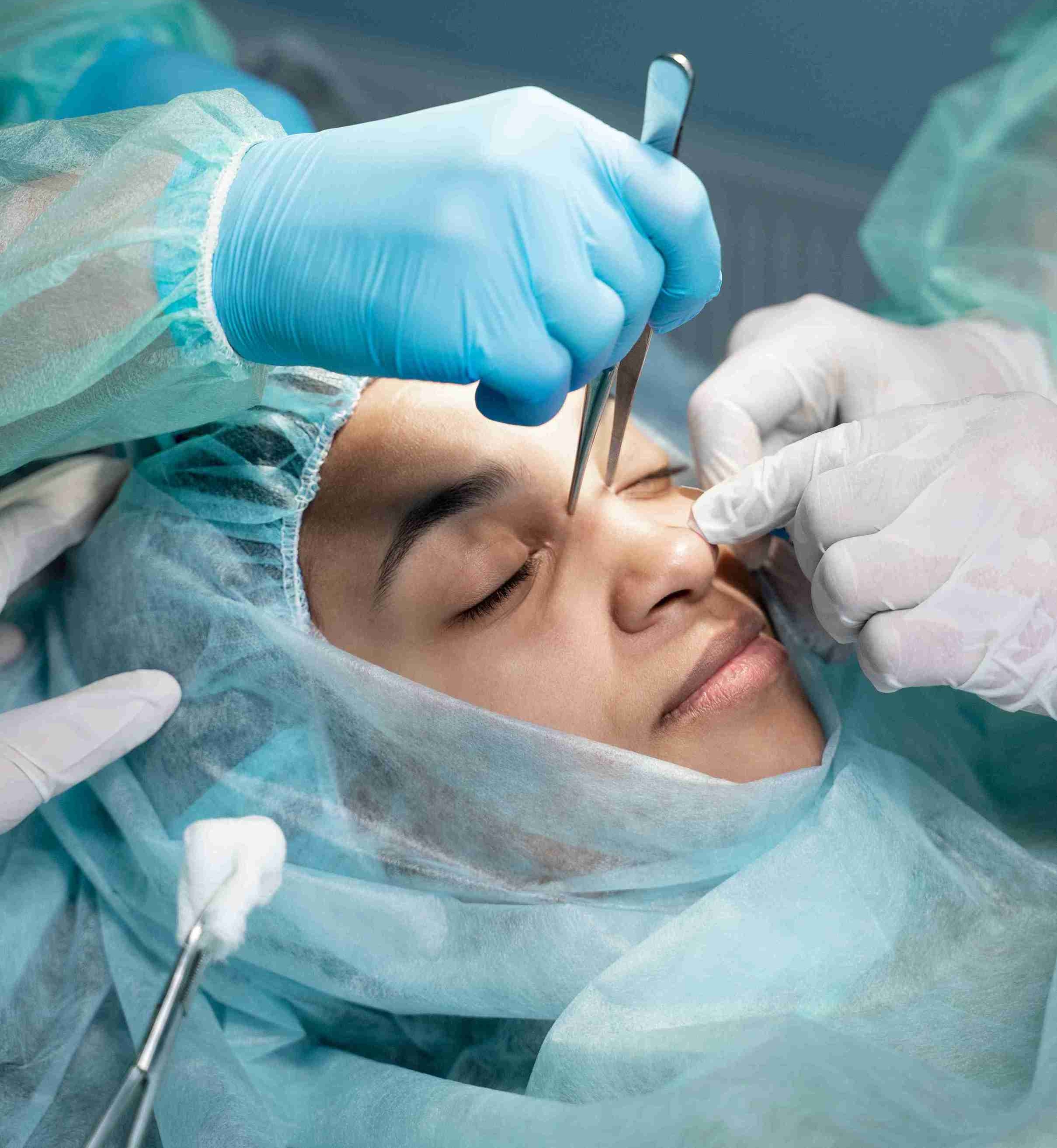 Rhinoplasty