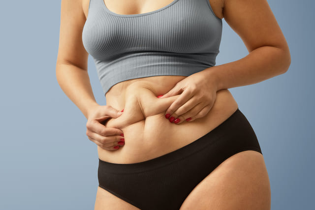Fix a Loose Abdomen After Weight Loss